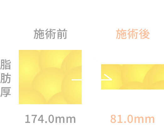 へそ上領域